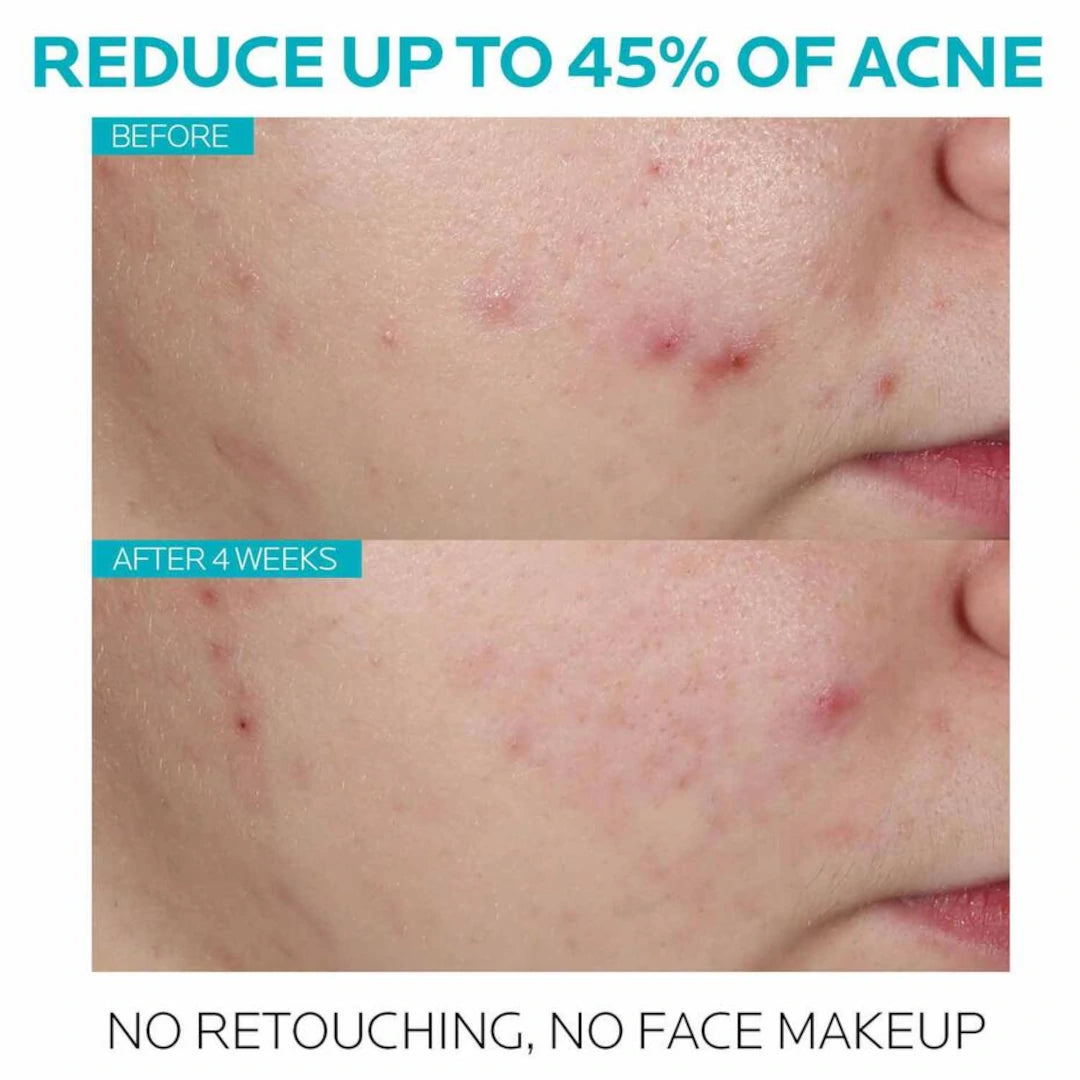 La Roche-Posay Effaclar Ultra Concentrated Serum.