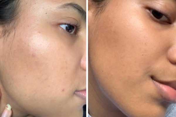 La Roche Posay - Pure Vitamin C10 Serum