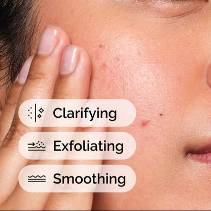 The Ordinary Salicylic Acid 2% Solution