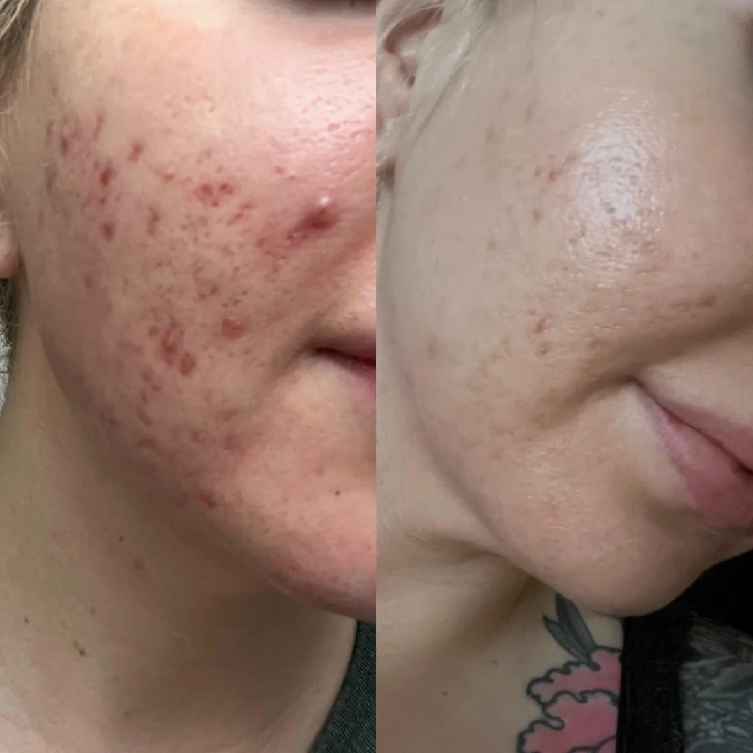 The Ordinary Mandelic Acid 10% + HA