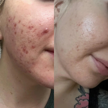 The Ordinary Mandelic Acid 10% + HA