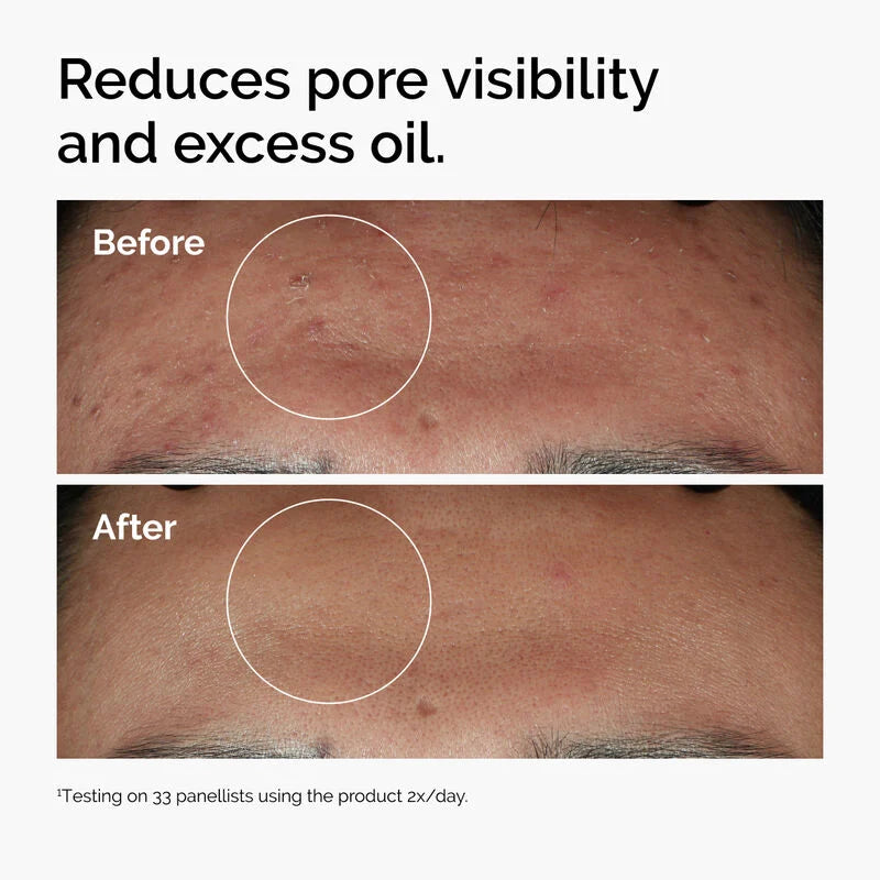 The Ordinary Niacinamide 10% + Zinc 1% - 30ml