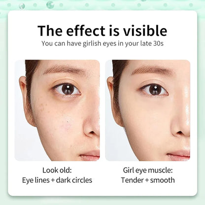 Ocheal Retinol Eye Cream with Massager