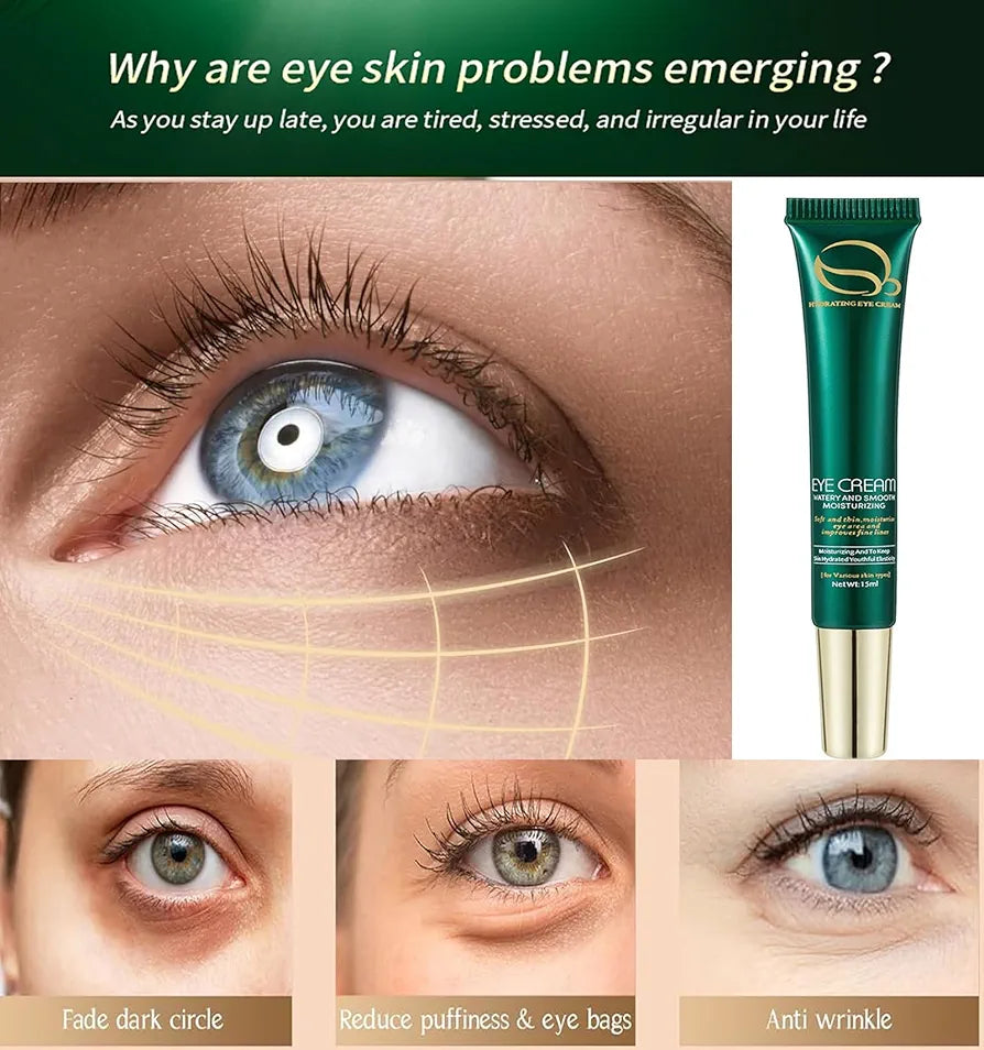 Ocheal Retinol Eye Cream with Massager